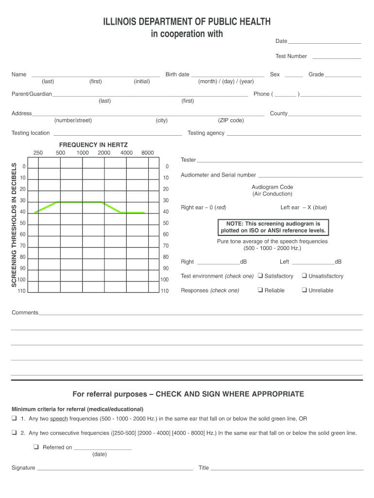 Blank Audiogram - Fill Online, Printable, Fillable, Blank With Blank Audiogram Template Download