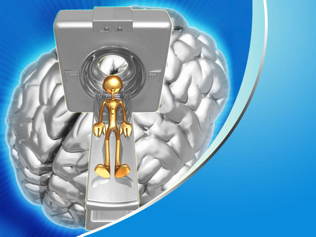 Brain Powerpoint Presentation Templates Free Powerpoint Inside Radiology Powerpoint Template