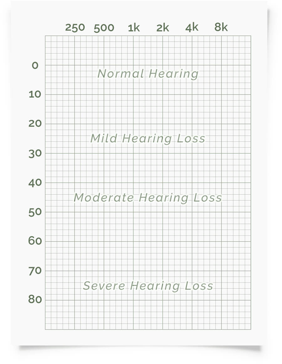 Online Hearing Test & Audiogram Printout Throughout Blank Audiogram Template Download