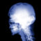 Skull Implants X Ray Backgrounds For Powerpoint – Health And Intended For Radiology Powerpoint Template